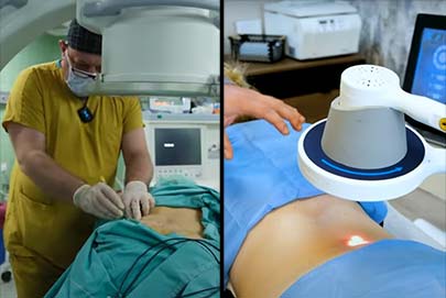 Nükleoplasti Nedir? Robotik Lazer - Radyofrekans - Nokta Atışı